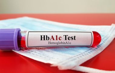 Гликированний гемоглобин (HbA1c)